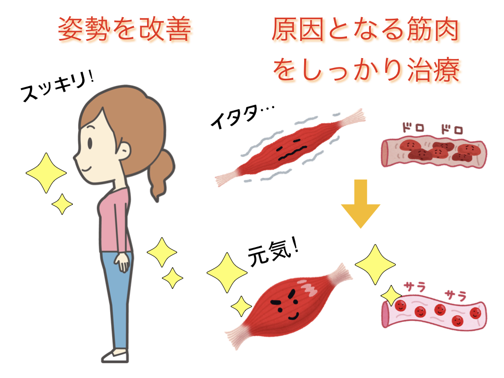 むちうち症の症状と治し方 はやし鍼灸整骨院